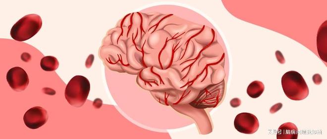 脑出血手术成功只是开场!这些脑出血后遗症你能否躲过?(图2)